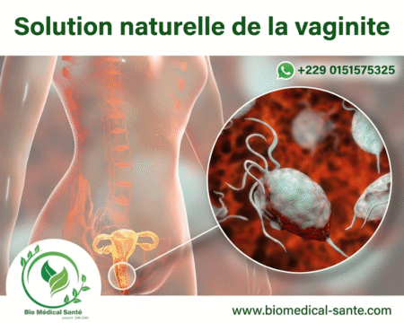 Solution naturelle de la vaginite