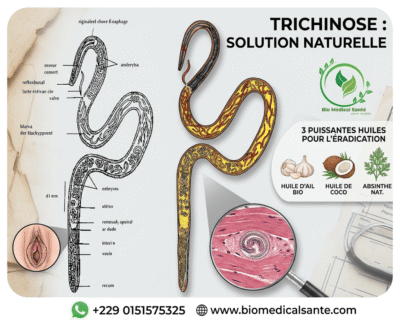 Trichinose solution naturelle