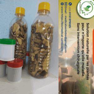 Varicocèle traitement naturel