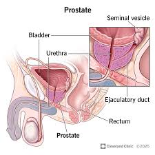 Cancer de la prostate solution naturelle