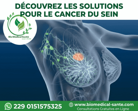 Cancer du sein traitement naturel