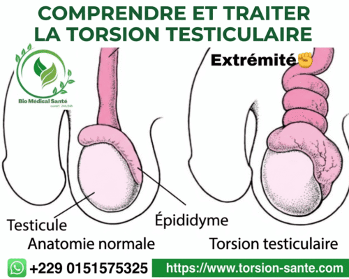 Orchiépididymite solution naturelle