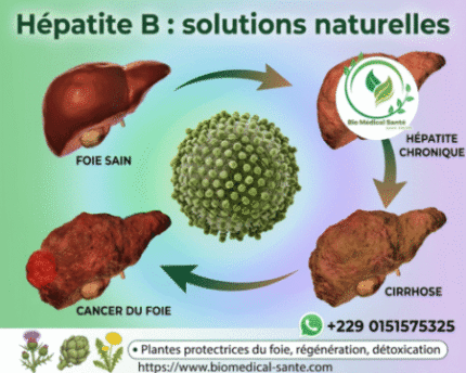 Hépatite B : Définition, Causes Et Traitement Naturel Hépatite b traitement naturel