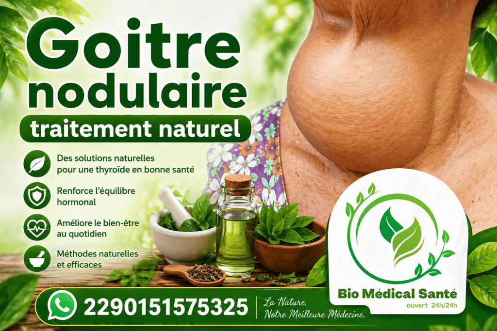 Goitre nodulaire traitement naturel
