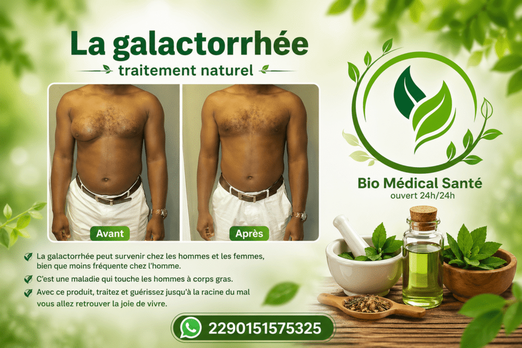 La galactorrhée traitement naturel