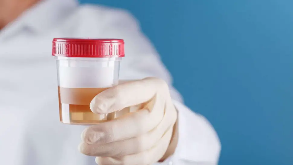 Comment soigner l'hématurie naturellement ?