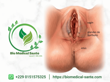 Bartholinite solution naturelle