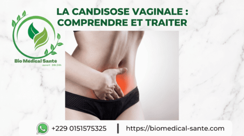 La Candidose Vaginale Traitement Naturel : Définition, Causes Et Symptômes La candidose vaginale traitement naturel